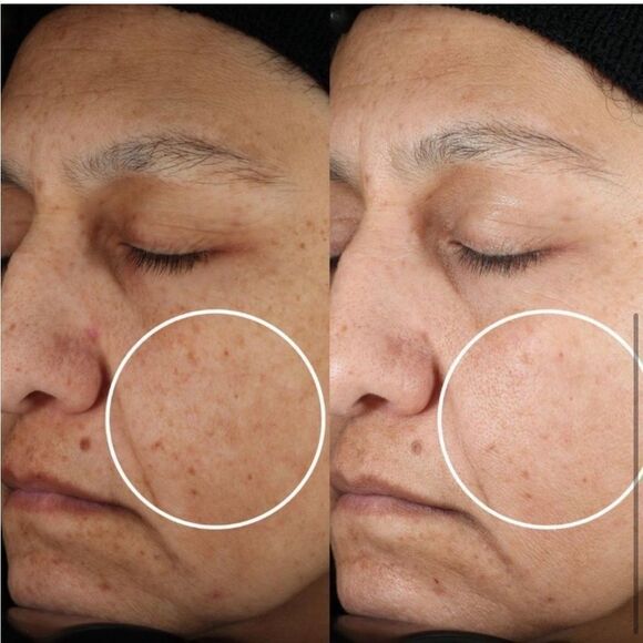 $6 🌙 BeautyStat Universal C Skin Refiner X2 NEW 20% Vitamin C - Picture 7 of 7